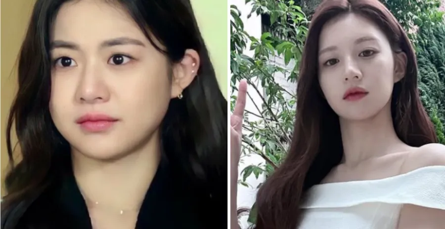 Actress Go Youn-jung: The #1 Plastic Surgery 'Wannabe' Mocking the Western 'Instagram Face' — Photo 1