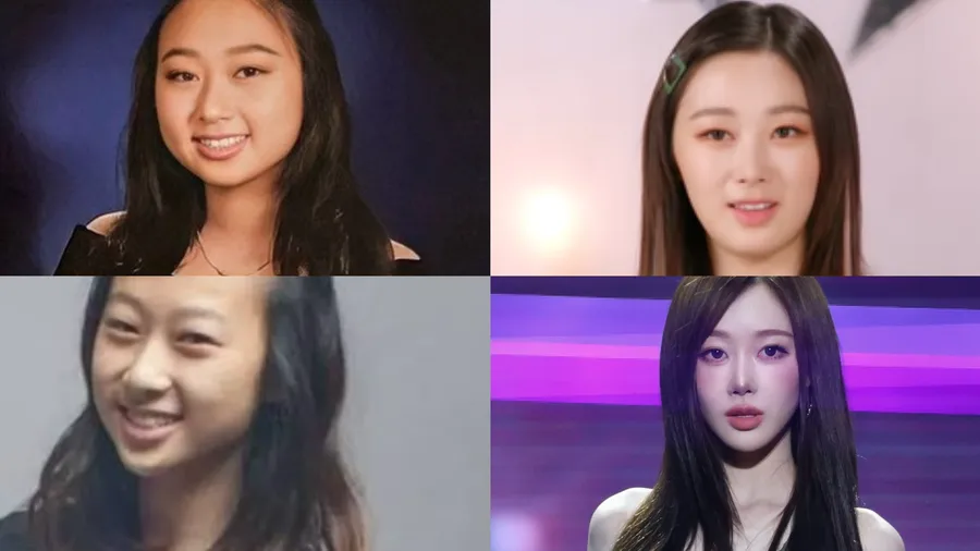 aespa Giselle's V-Line: The Truth Behind Korea's 'Non-Surgical Facial Contouring' — Photo 1