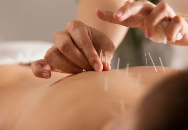 The Scientific Truth Behind 'Korean Acupuncture' That Shocks Painkiller-Dependent Westerners — Photo 1