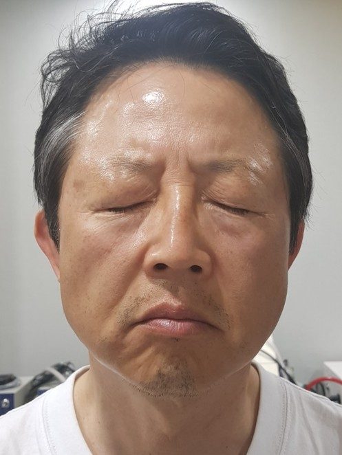 Before